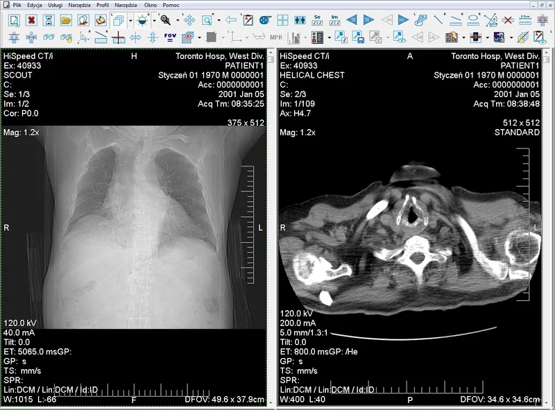 Работа с Efilm Lite